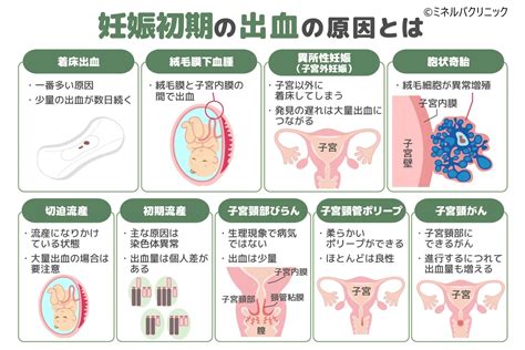 胎盤形成出血|妊娠初期の出血は何が原因？ 心配のない出血と注意。